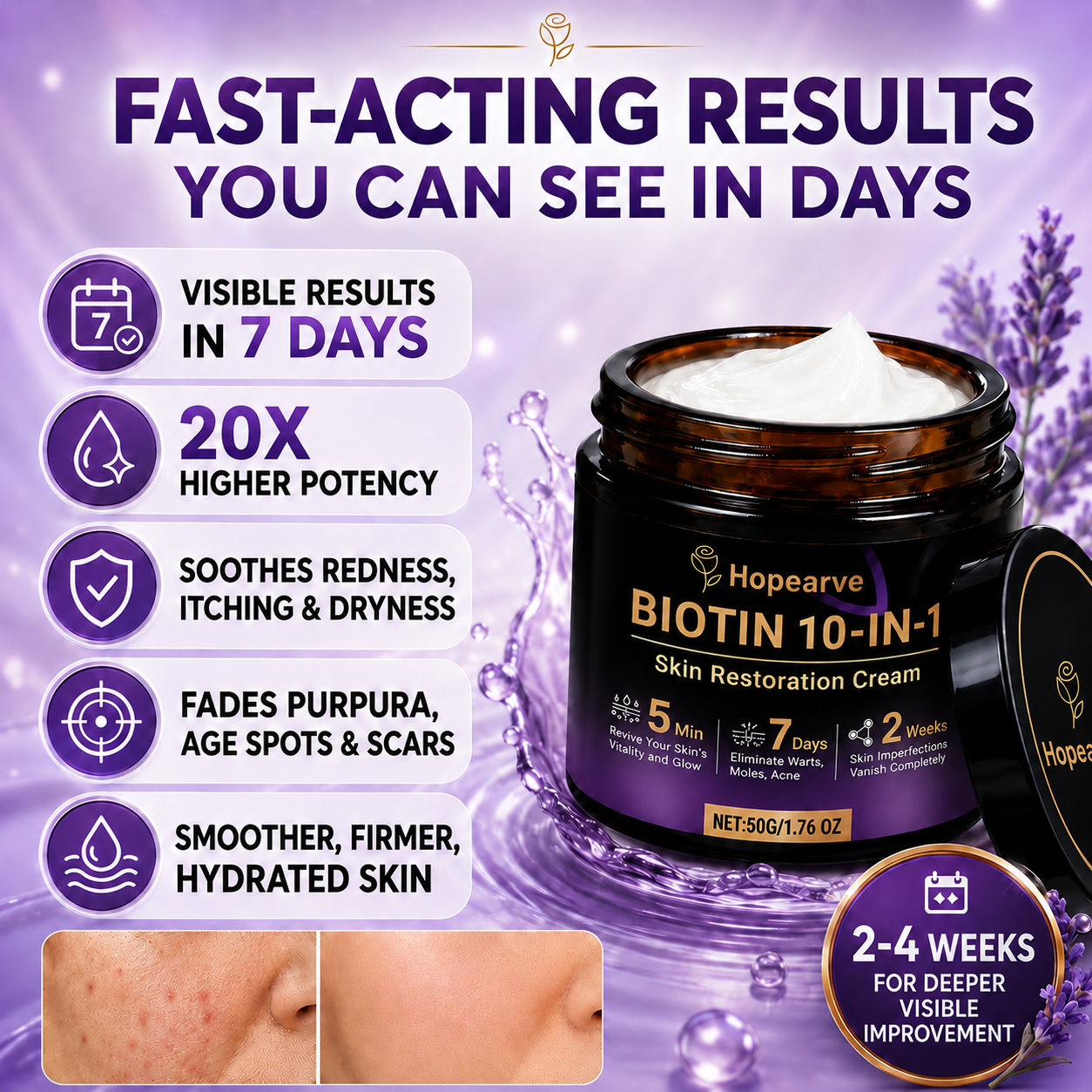 ✨Hopearve® Biotin 10-in-1 Skin Cream🍀