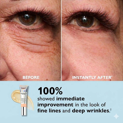 Voppov Instant Face Temporary Tightener – Instant visible results in 60 seconds