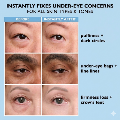 Voppov Instant Face Temporary Tightener – Instant visible results in 60 seconds